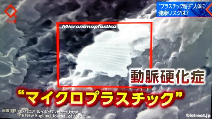 人の体内から検出されたプラーク状のマイクロプラスチック画像